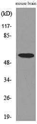 CPE Rabbit Polyclonal Antibody