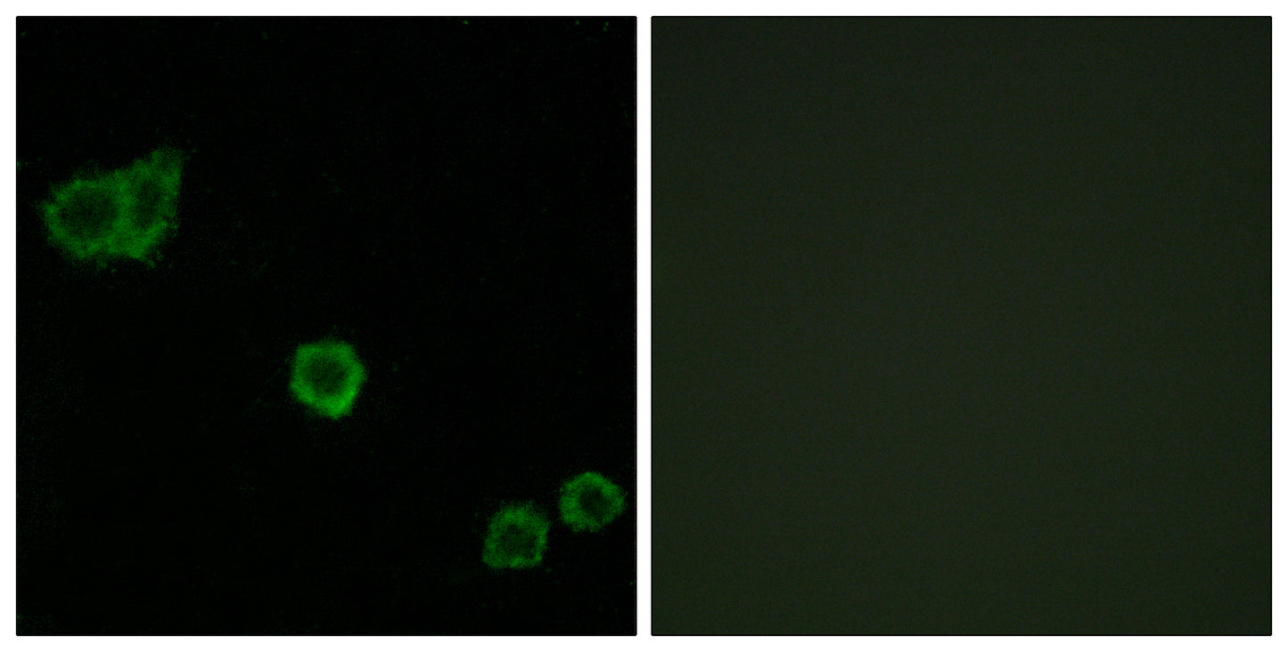 CPI-17 Rabbit Polyclonal Antibody
