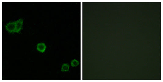 CPI-17 Rabbit Polyclonal Antibody