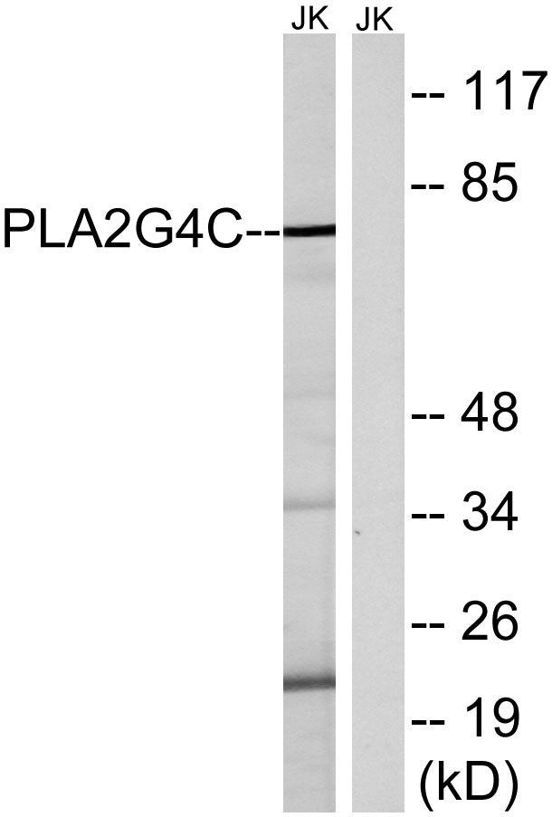cPLA2-γ Rabbit Polyclonal Antibody