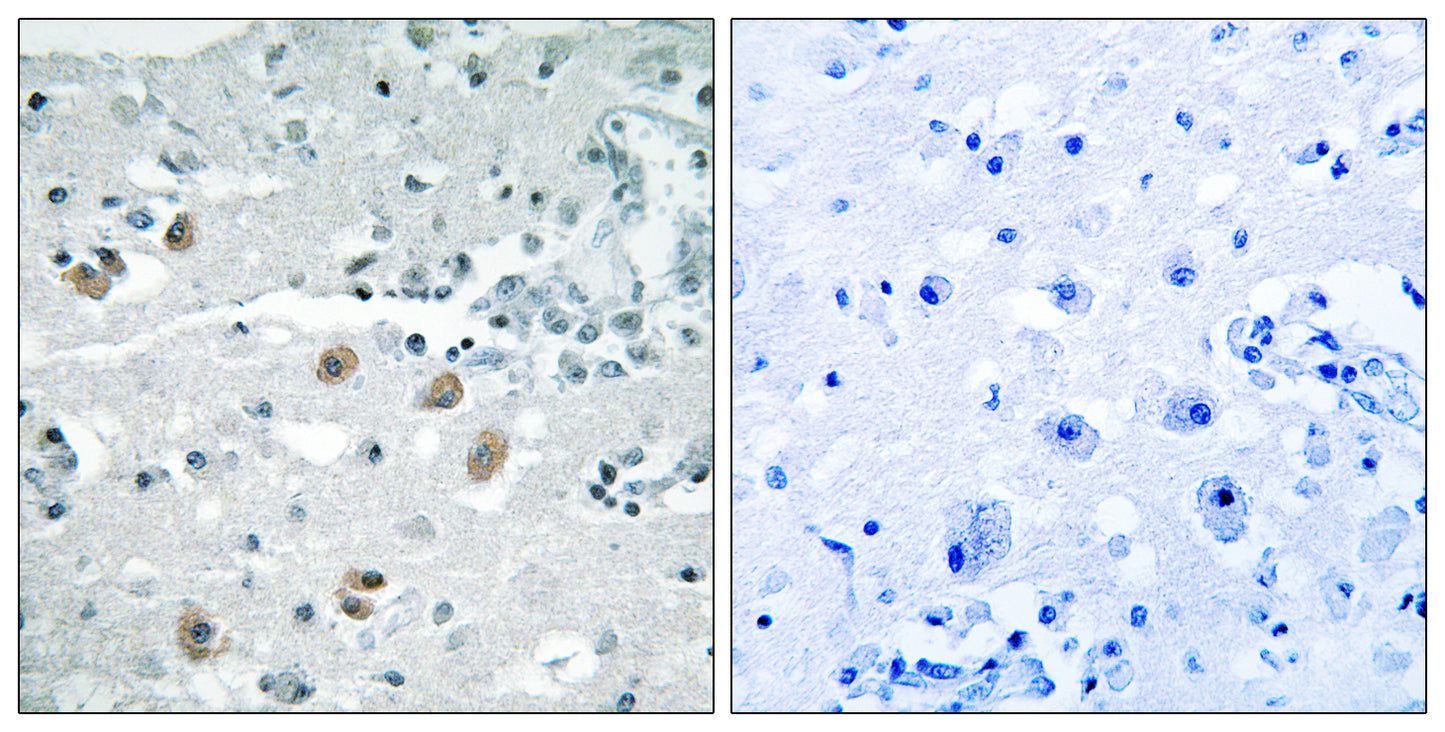 cPLA2-δ Rabbit Polyclonal Antibody