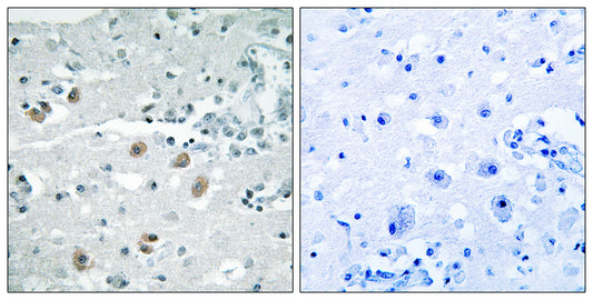cPLA2-δ Rabbit Polyclonal Antibody