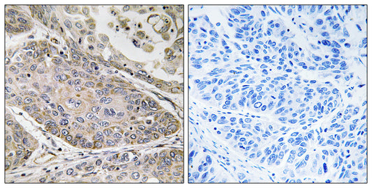 cPLA2-ε Rabbit Polyclonal Antibody