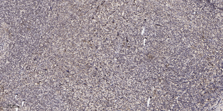 CPXM2 Rabbit Polyclonal Antibody