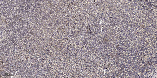 CPXM2 Rabbit Polyclonal Antibody