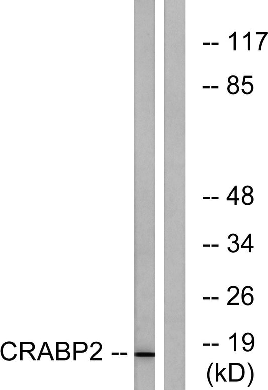 CRABP-II Rabbit Polyclonal Antibody