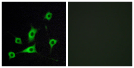 CRBP-III Rabbit Polyclonal Antibody
