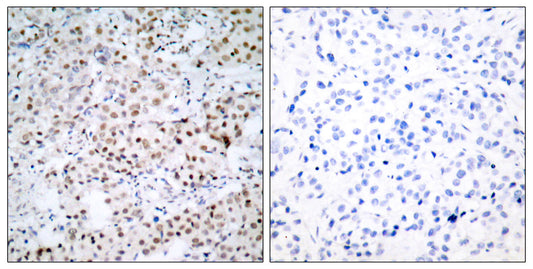 CREB-1 Rabbit Polyclonal Antibody
