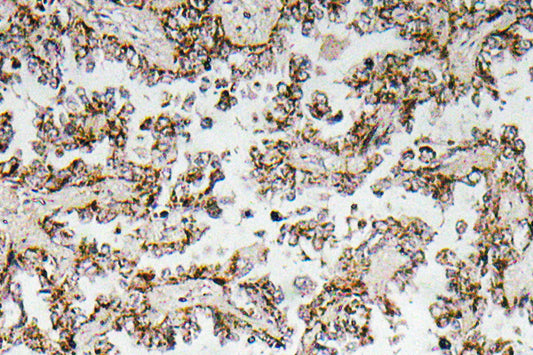 CRF Rabbit Polyclonal Antibody