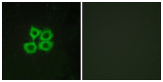 CRF-RII Rabbit Polyclonal Antibody