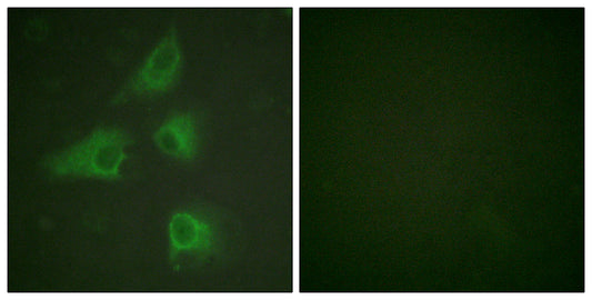 CRMP-2 Rabbit Polyclonal Antibody