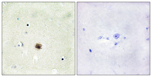CRP1 Rabbit Polyclonal Antibody