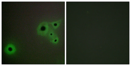 CRSP130 Rabbit Polyclonal Antibody