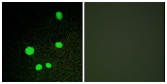 CRSP150 Rabbit Polyclonal Antibody