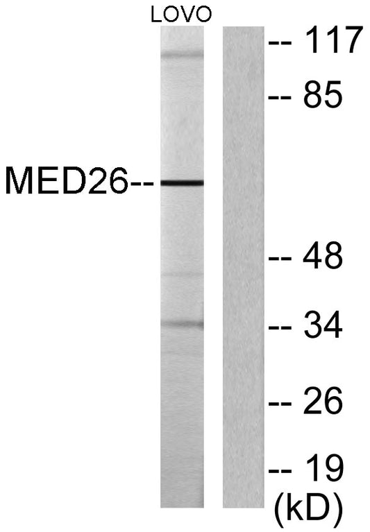 CRSP70 Rabbit Polyclonal Antibody