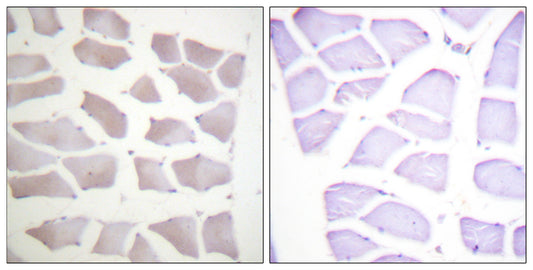 Crystallin-αB Rabbit Polyclonal Antibody