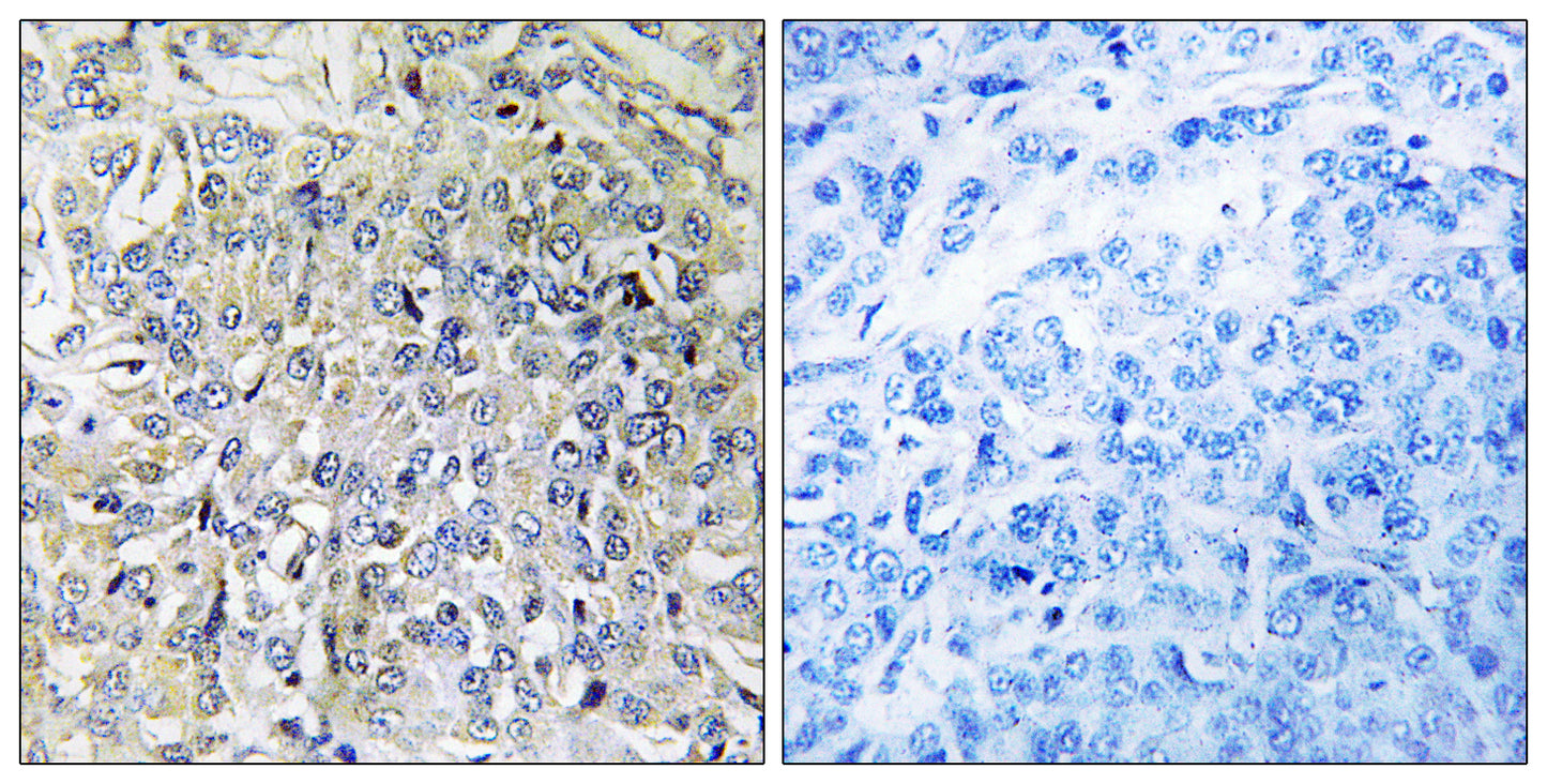 CsGalNAcT-2 Rabbit Polyclonal Antibody