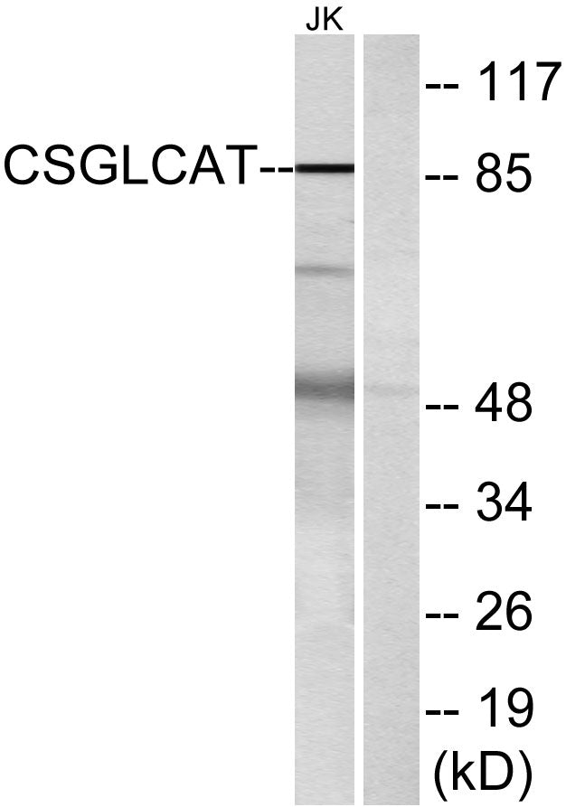 CSGlcA-T Rabbit Polyclonal Antibody