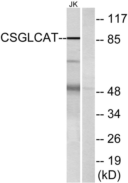 CSGlcA-T Rabbit Polyclonal Antibody