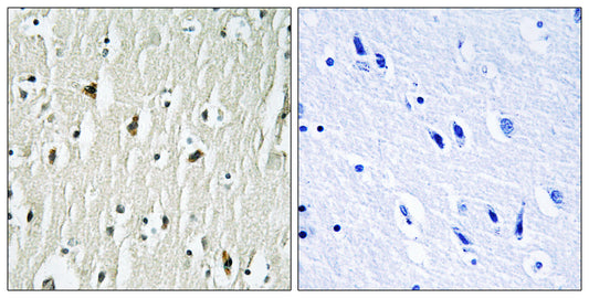 Csk Rabbit Polyclonal Antibody