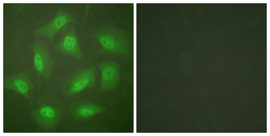 CSN3 Rabbit Polyclonal Antibody