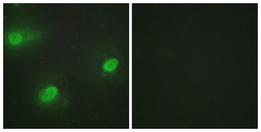CstF-64 Rabbit Polyclonal Antibody