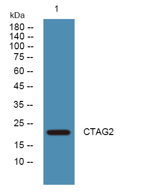CTAG2 Rabbit Polyclonal Antibody