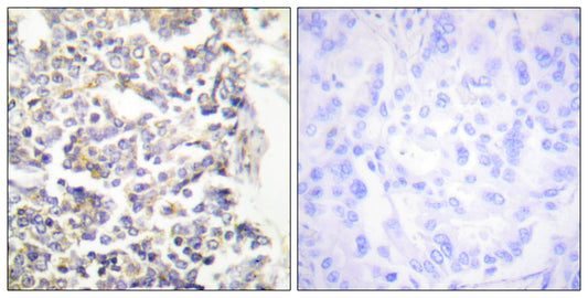 C-TAK1 Rabbit Polyclonal Antibody