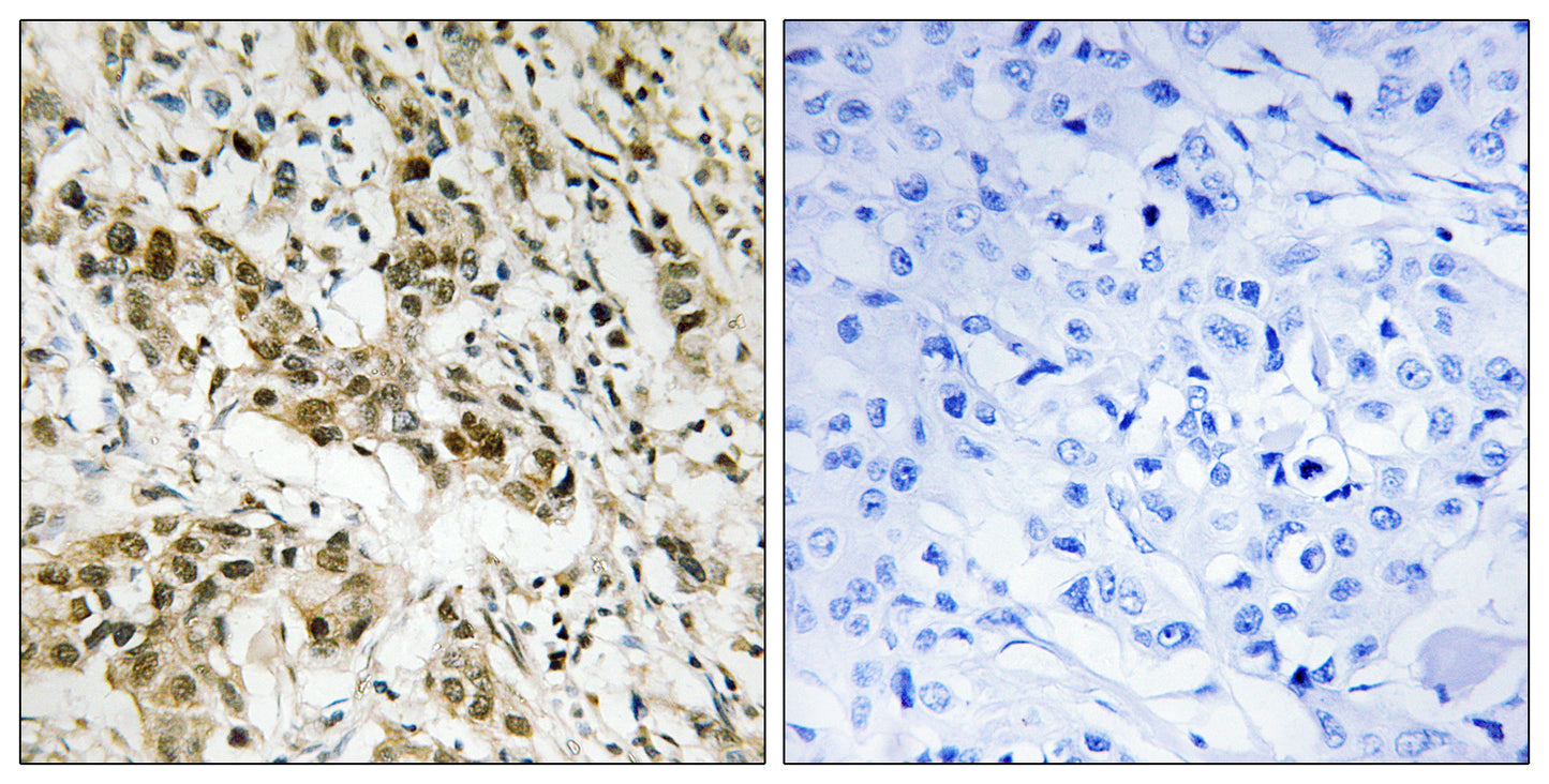 CtBP1 Rabbit Polyclonal Antibody