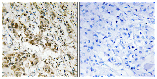 CtBP1 Rabbit Polyclonal Antibody