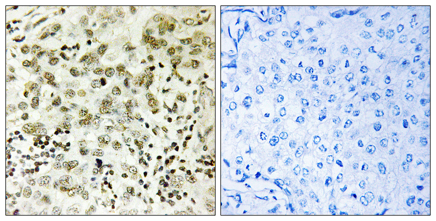 CTDSP1 Rabbit Polyclonal Antibody