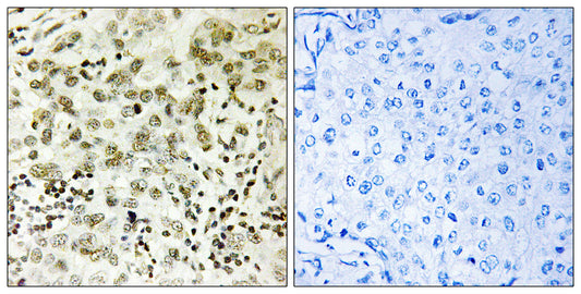 CTDSP1 Rabbit Polyclonal Antibody