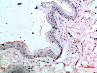 CTGF Rabbit Polyclonal Antibody
