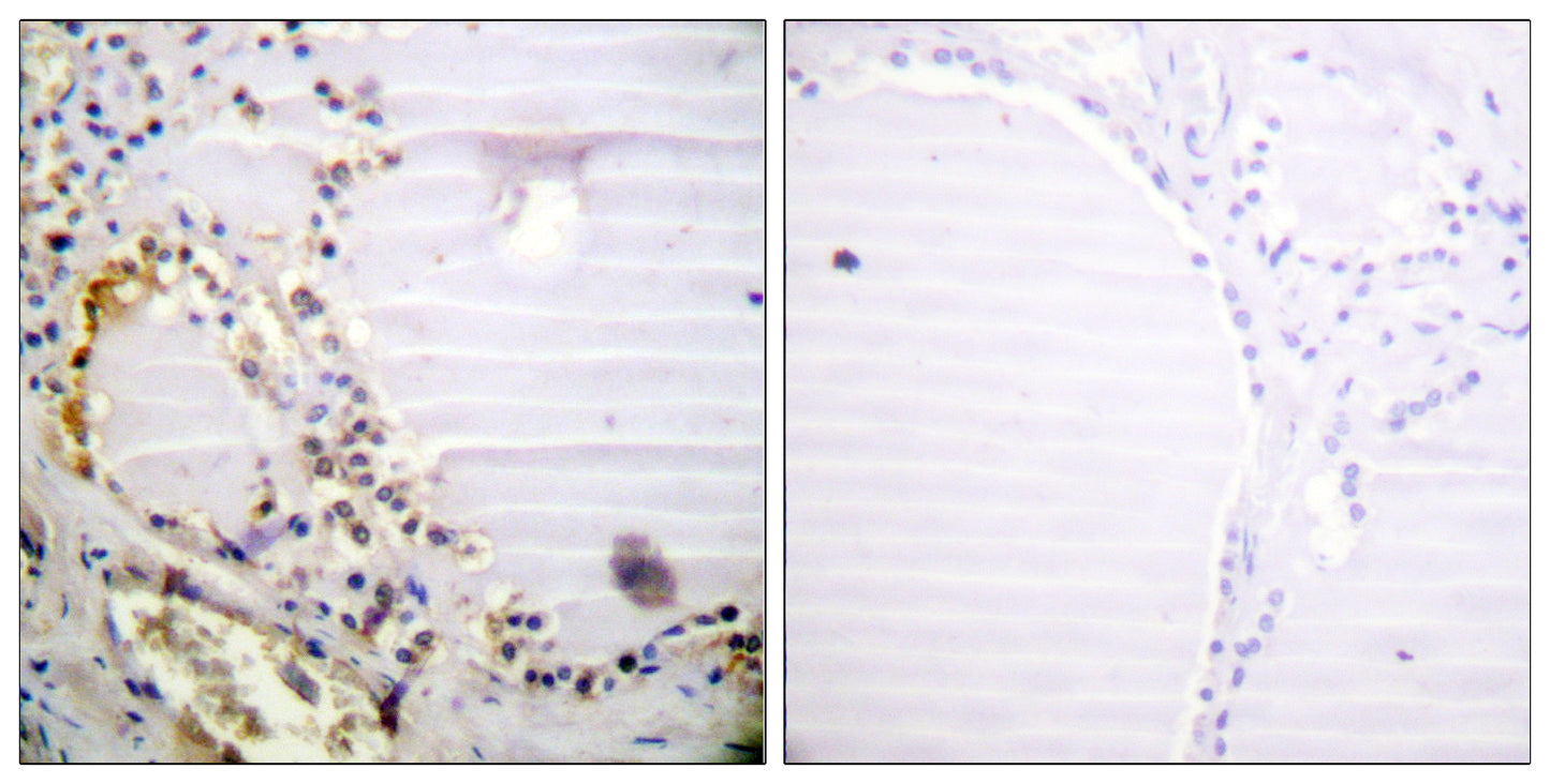 CtIP Rabbit Polyclonal Antibody
