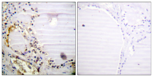 CtIP Rabbit Polyclonal Antibody