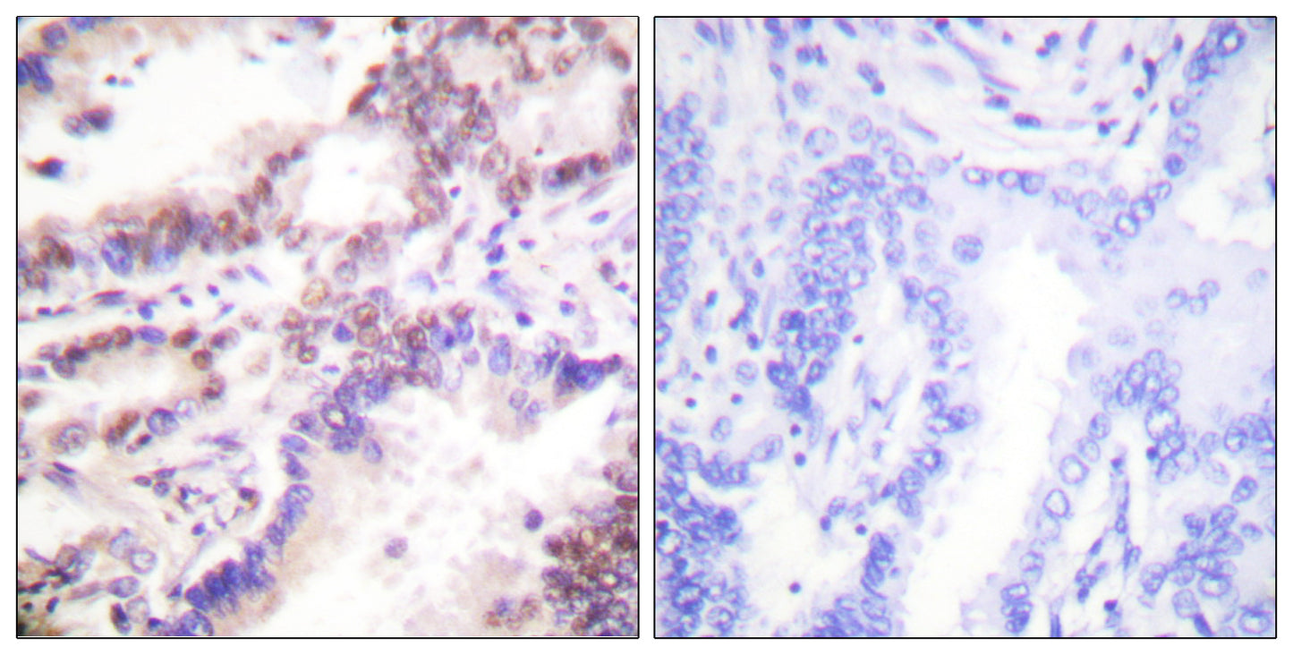 CtIP Rabbit Polyclonal Antibody