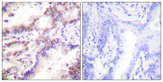 CtIP Rabbit Polyclonal Antibody