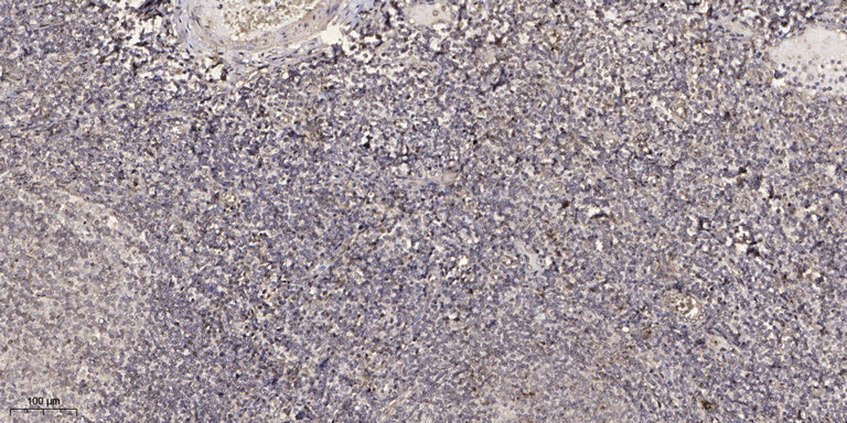 CTRP8 Rabbit Polyclonal Antibody