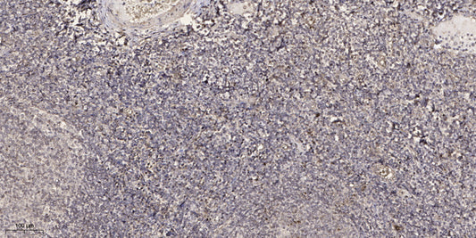 CTRP8 Rabbit Polyclonal Antibody