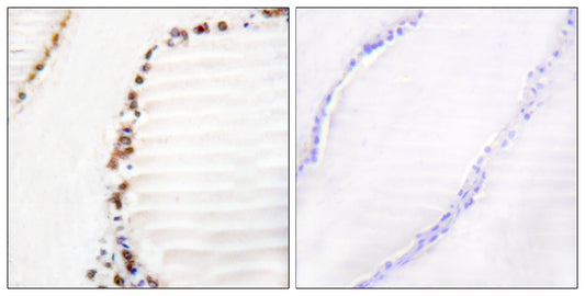 CUL-3 Rabbit Polyclonal Antibody