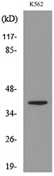 CXCR-3 Rabbit Polyclonal Antibody