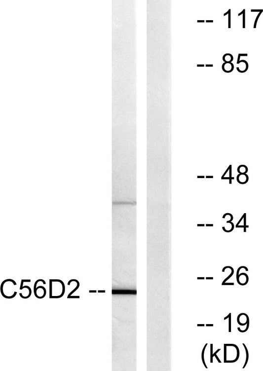 CYB561D2 Rabbit Polyclonal Antibody