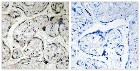 CYB5R3 Rabbit Polyclonal Antibody