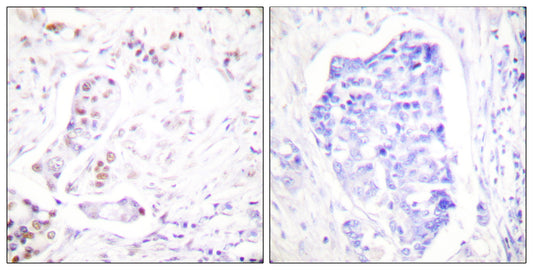 Cyclin A1 Rabbit Polyclonal Antibody