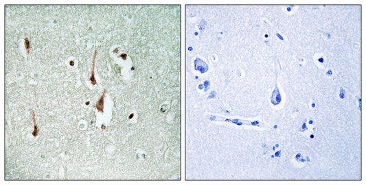 Cyclin D1 Rabbit Polyclonal Antibody