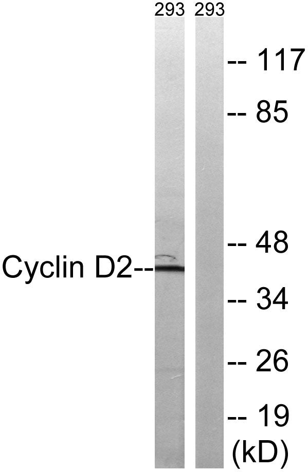 Cyclin D2 Rabbit Polyclonal Antibody