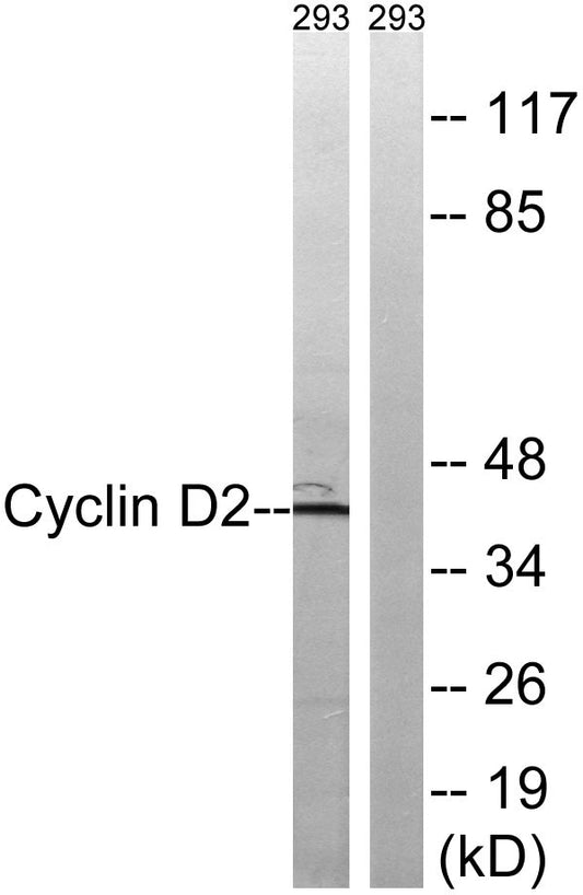 Cyclin D2 Rabbit Polyclonal Antibody