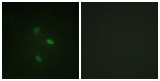 Cyclin E2 Rabbit Polyclonal Antibody
