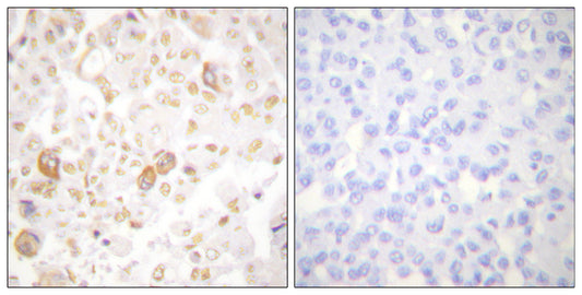 Cyclin F Rabbit Polyclonal Antibody