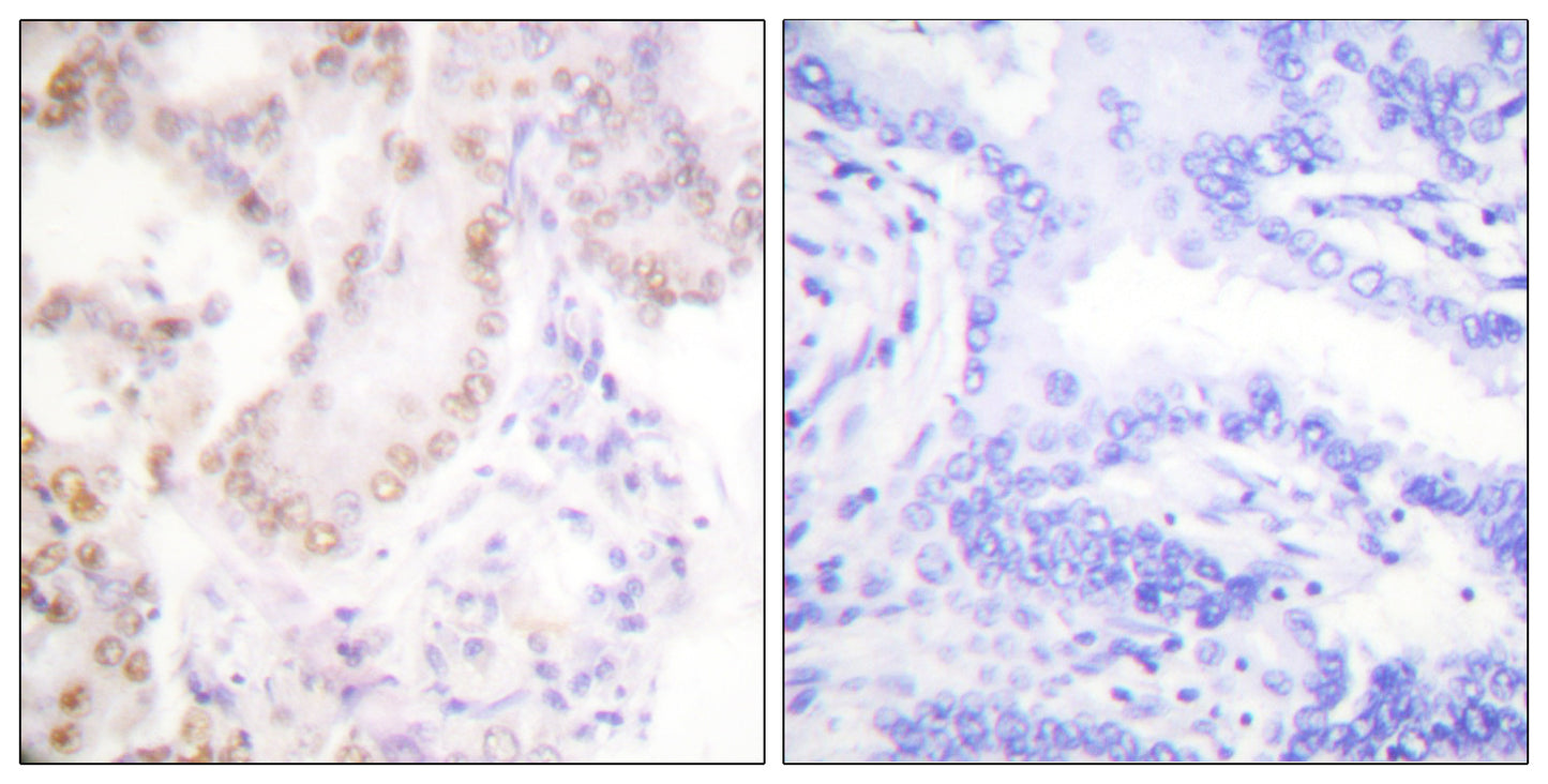 Cyclin G Rabbit Polyclonal Antibody